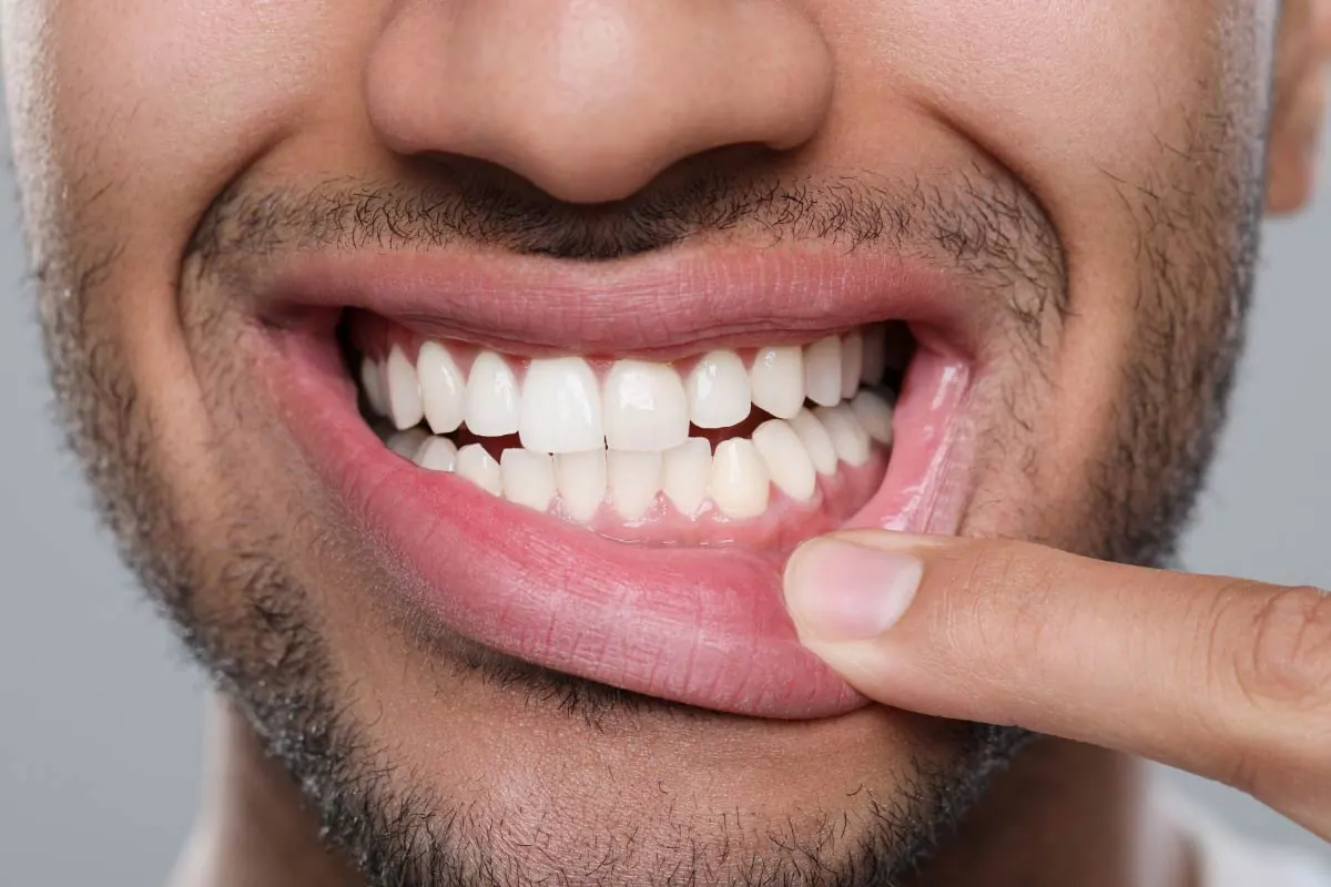 man showing off his healthy teeth and gums thanks to regular cleanings from Rugby Dental Arts in Charlottesville, VA