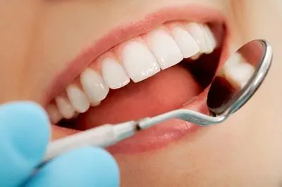 closeup of a woman's smile after getting dental veneers from Rugby Dental Arts in Charlottesville, VA