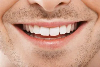 close up of a man's smile after getting dental implants from Rugby Dental Arts in Charlottesville, VA